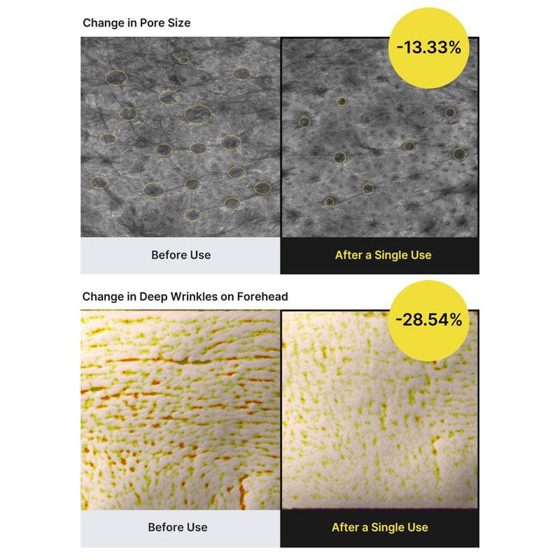 The Vita A Retinal Shot Tightening Booster